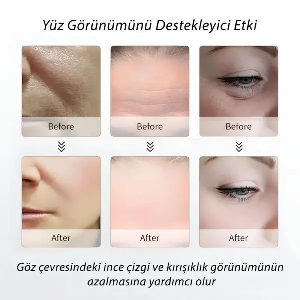 M2 Kırışıklı Önleyici 3